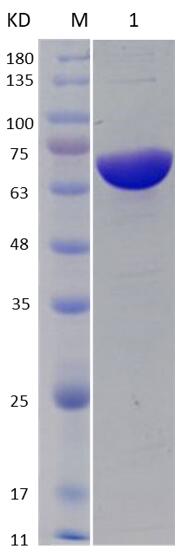 12% SDS-PAGE analysis profiles of purified NTHI0370-27-565 (CBB stained).